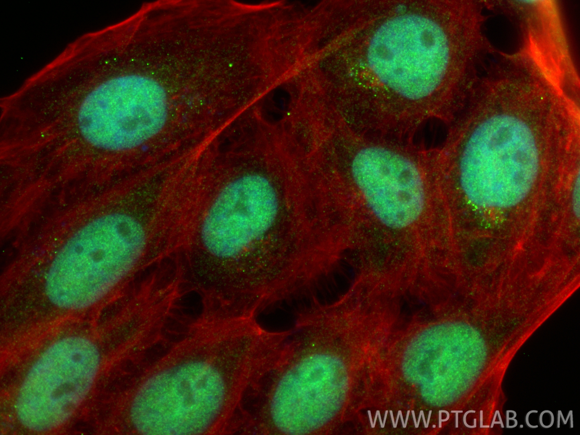 IF Staining of A431 using 11432-1-AP IF Staining of A431 using 11432-1-AP