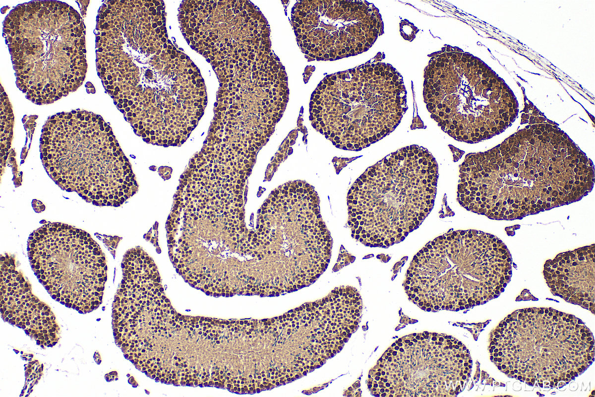 Immunohistochemical analysis of paraffin-embedded mouse testis tissue slide using 11432-1-AP (HAT1 antibody) at dilution of 1:500 (under 10x lens). Heat mediated antigen retrieval with Tris-EDTA buffer (pH 9.0). IHC staining of mouse testis using 11432-1-AP