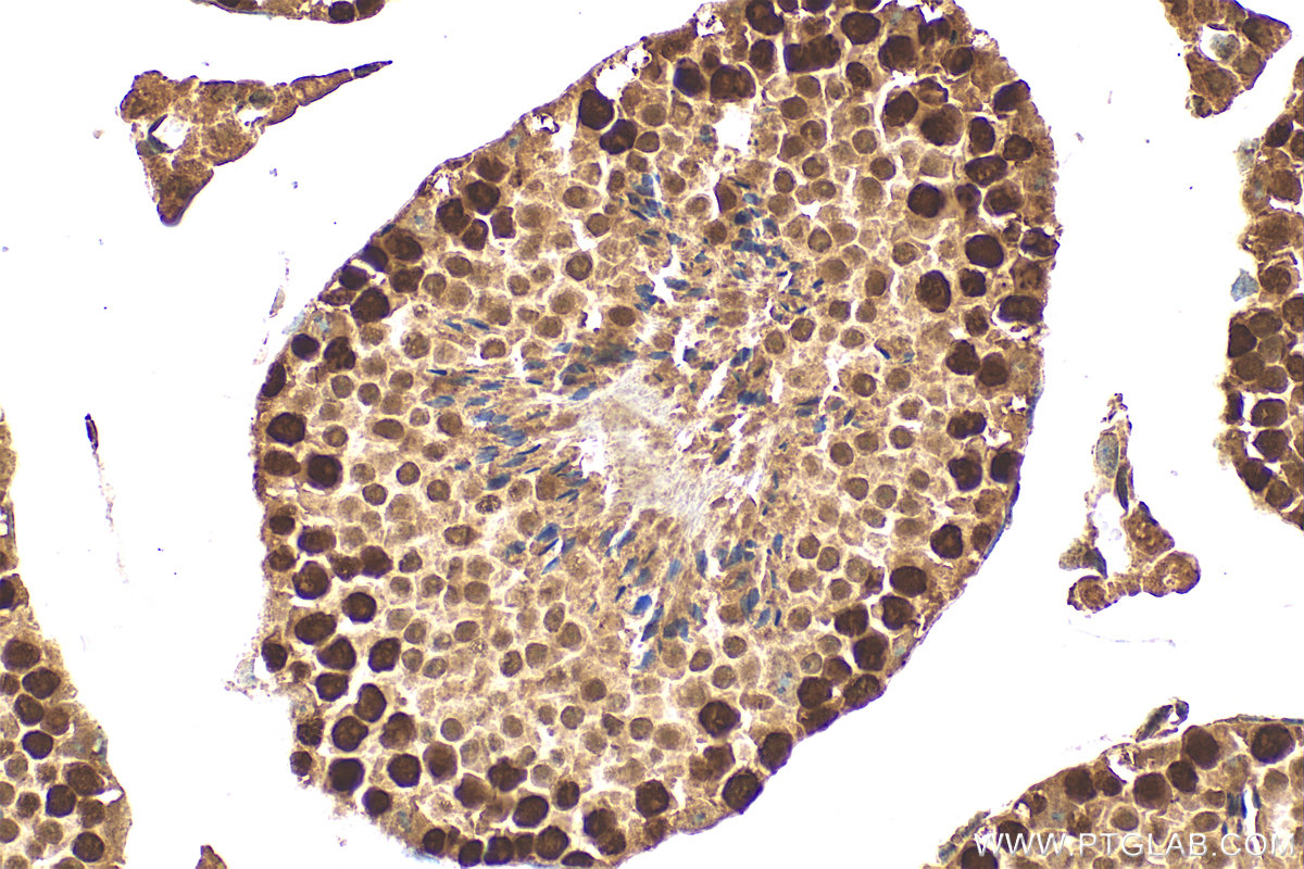 Immunohistochemical analysis of paraffin-embedded mouse testis tissue slide using 11432-1-AP (HAT1 antibody) at dilution of 1:500 (under 40x lens). Heat mediated antigen retrieval with Tris-EDTA buffer (pH 9.0). IHC staining of mouse testis using 11432-1-AP