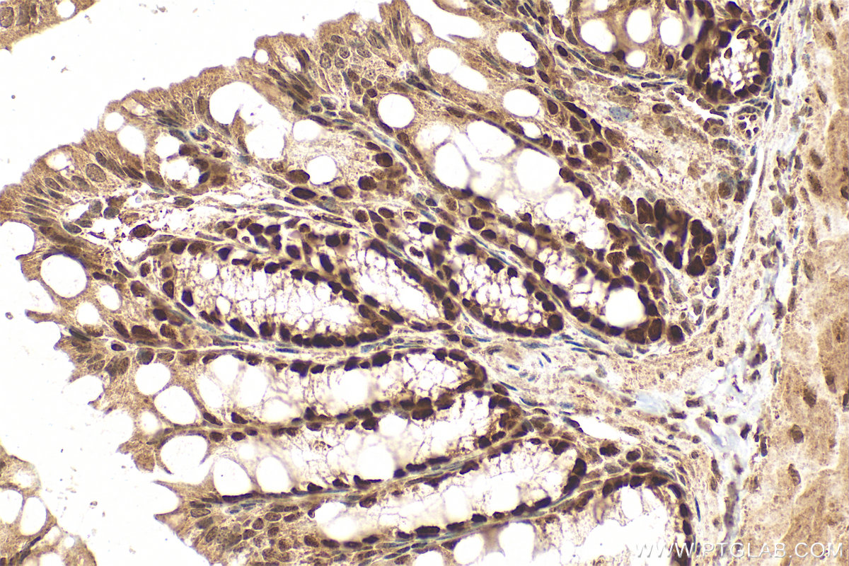 IHC staining of mouse colon using 11432-1-AP