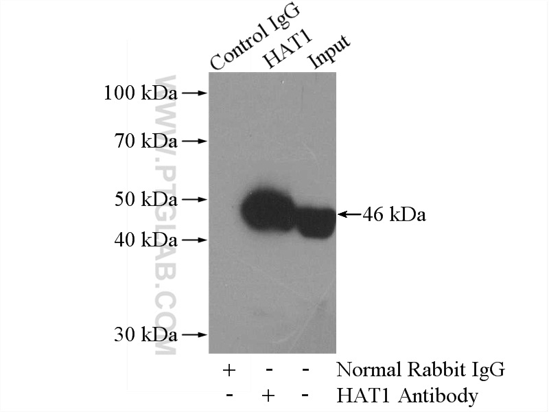 IP experiment of HepG2 using 11432-1-AP