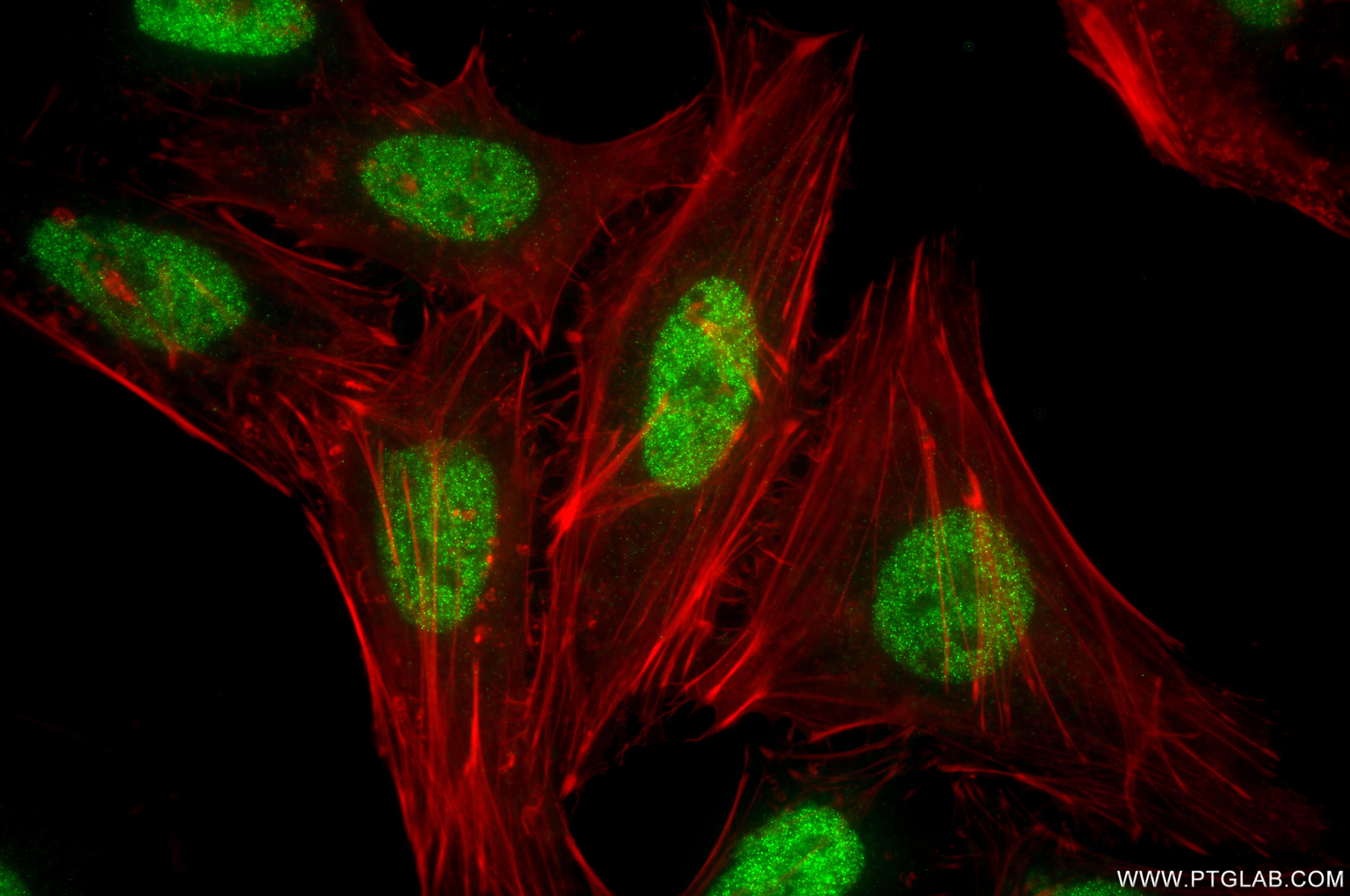 IF Staining of HeLa using 86815-1-RR IF Staining of HeLa using 86815-1-RR
