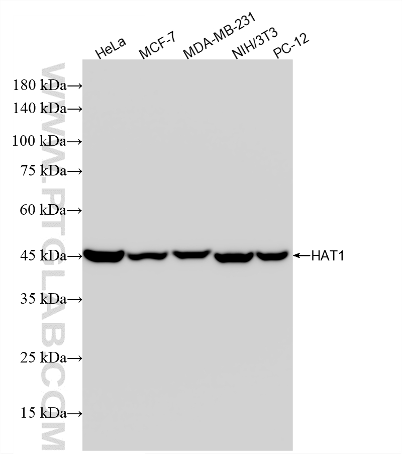 WB analysis using 86815-1-RR WB analysis using 86815-1-RR