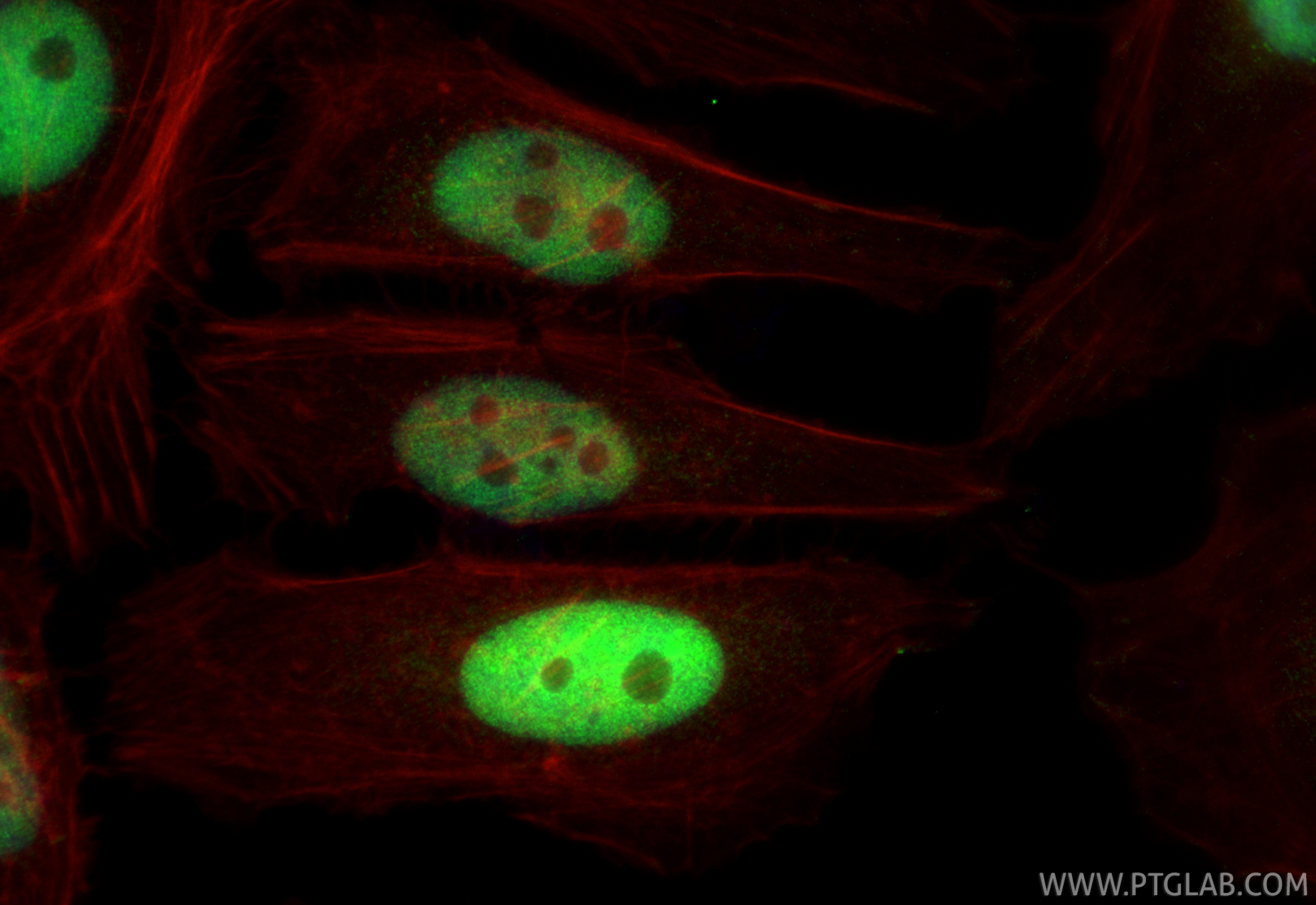 IF Staining of HeLa using RMX00092 IF Staining of HeLa using RMX00092
