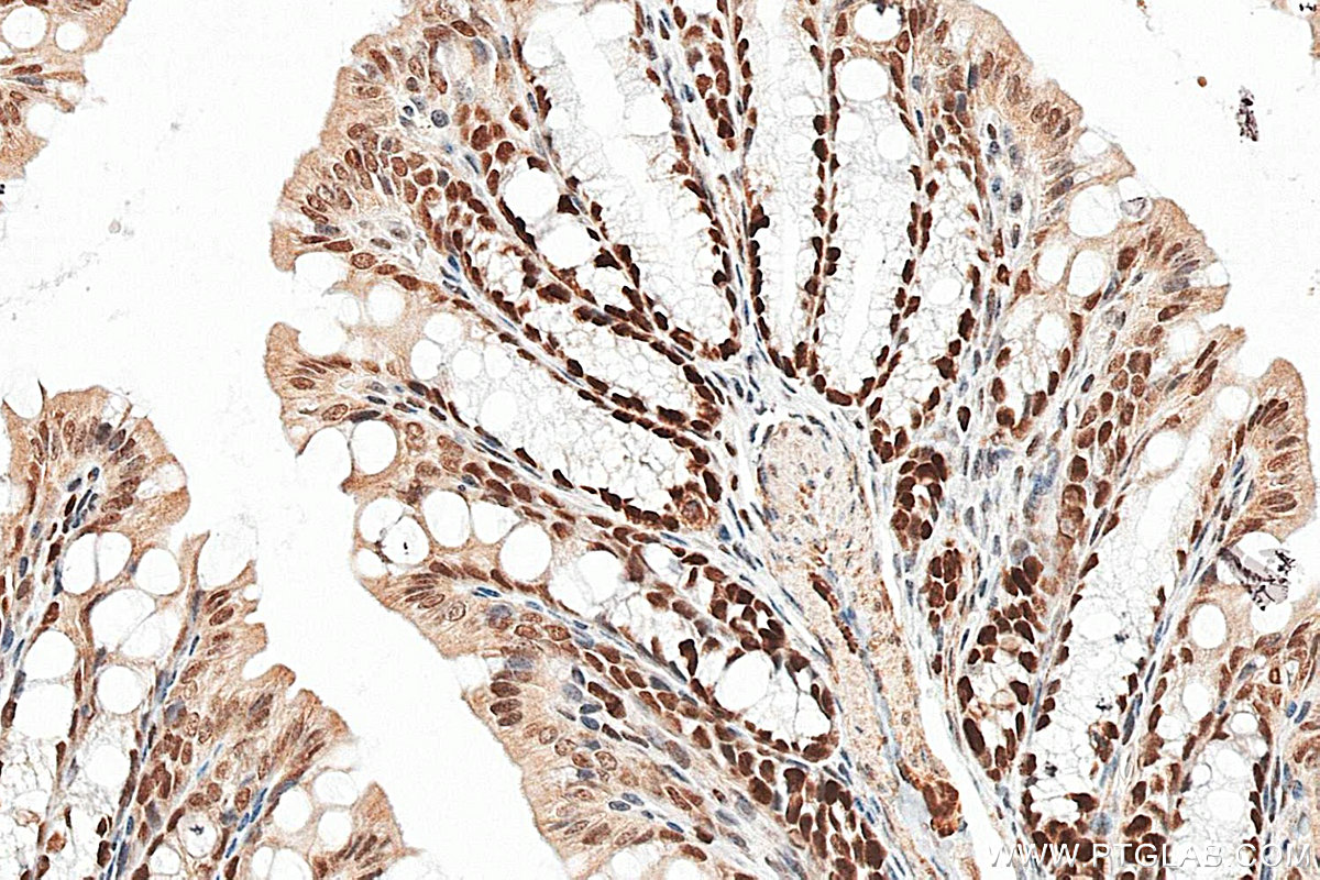 IHC staining of mouse colon using RMX00092 IHC staining of mouse colon using RMX00092