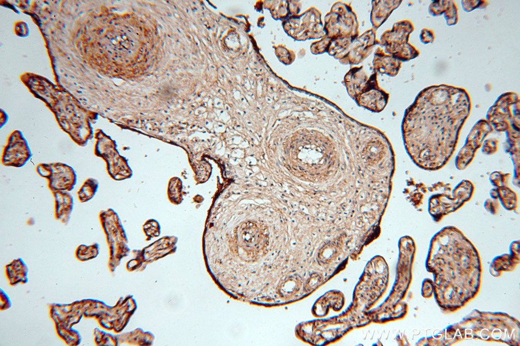 IHC staining of human placenta using 20104-1-AP