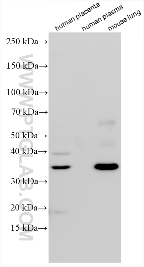 Various lysates were subjected to SDS PAGE followed by western blot with 20104-1-AP (HAUS4 antibody) at dilution of 1:1000 incubated at room temperature for 1.5 hours. WB analysis using 20104-1-AP