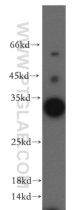 WB analysis of human brain using 20104-1-AP