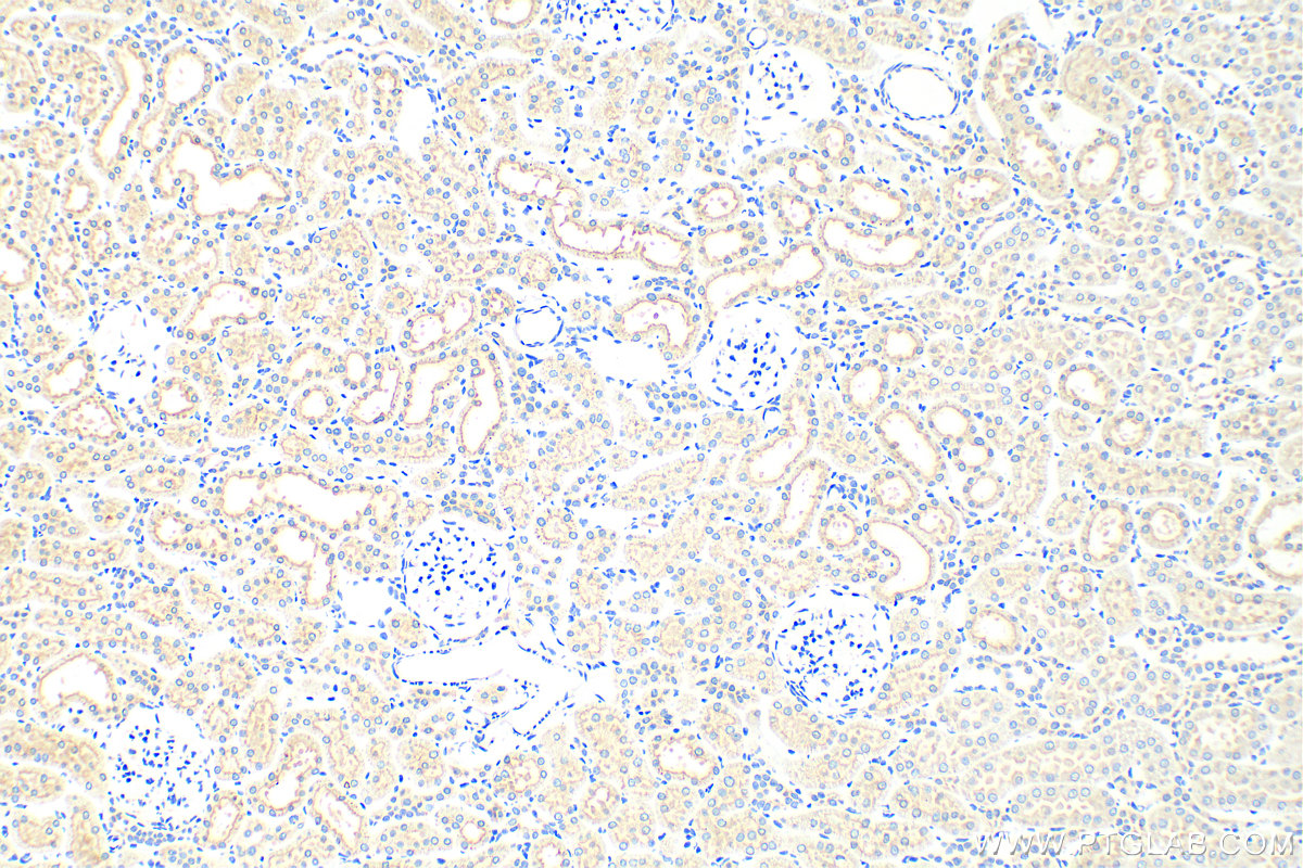 IHC staining of rat kidney using 30948-1-AP