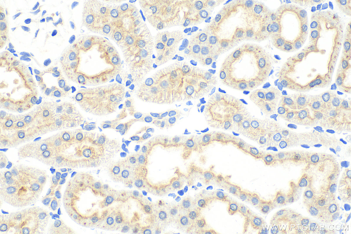 IHC staining of rat kidney using 30948-1-AP