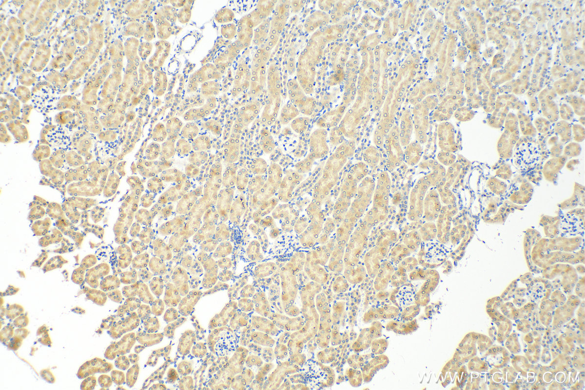 IHC staining of mouse kidney using 30948-1-AP
