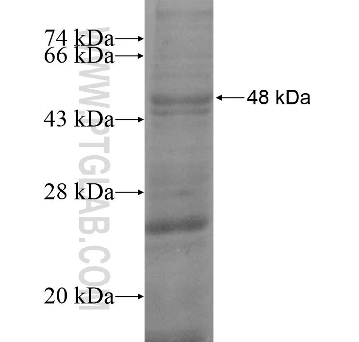 HAVCR1 fusion protein Ag13126 SDS-PAGE HAVCR1 fusion protein Ag13126 SDS-PAGE