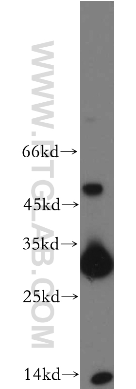 TIM3 Polyclonal antibody