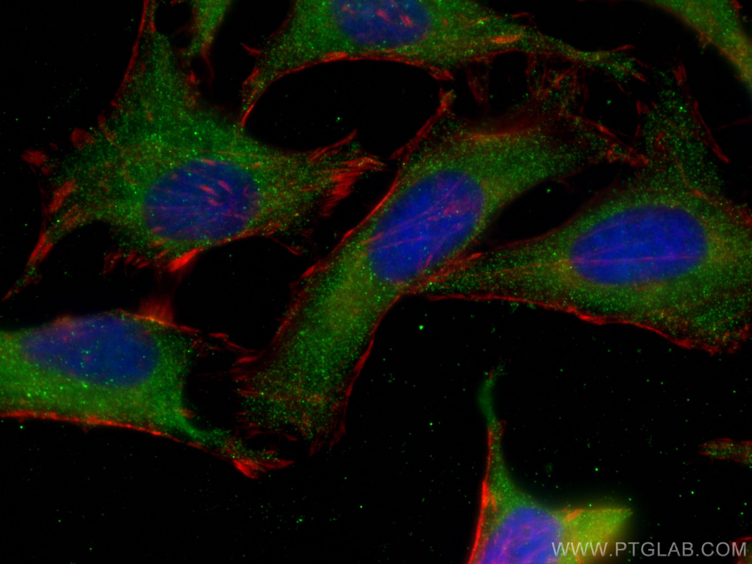 IF Staining of HeLa using 67883-2-Ig (same clone as 67883-2-PBS)