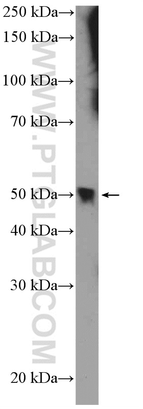 WB analysis of mouse spleen using 20975-1-AP