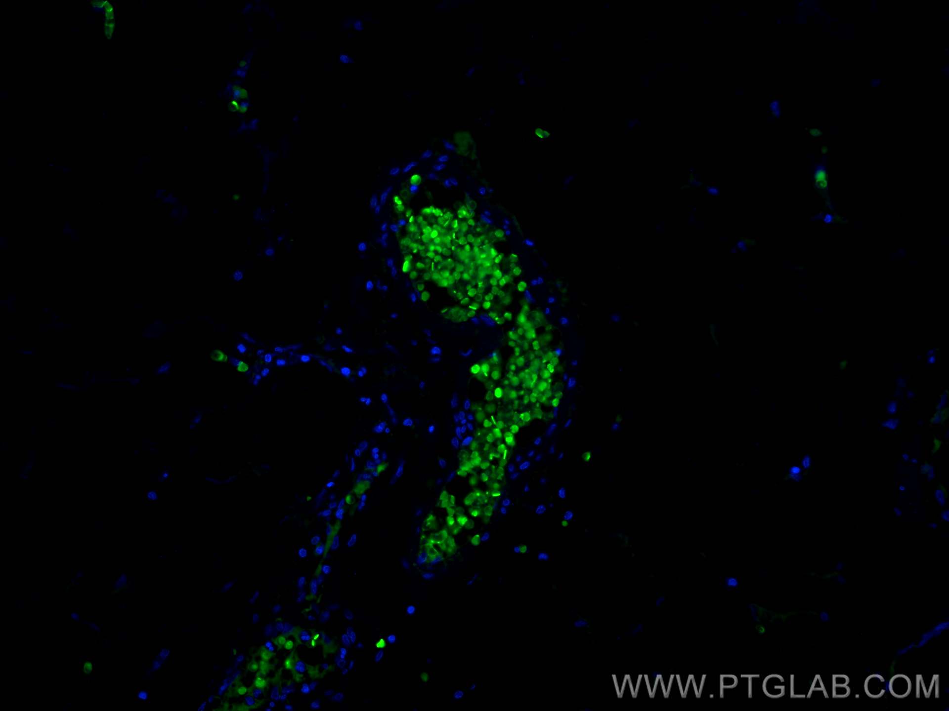 IF Staining of human appendicitis using 14537-1-AP