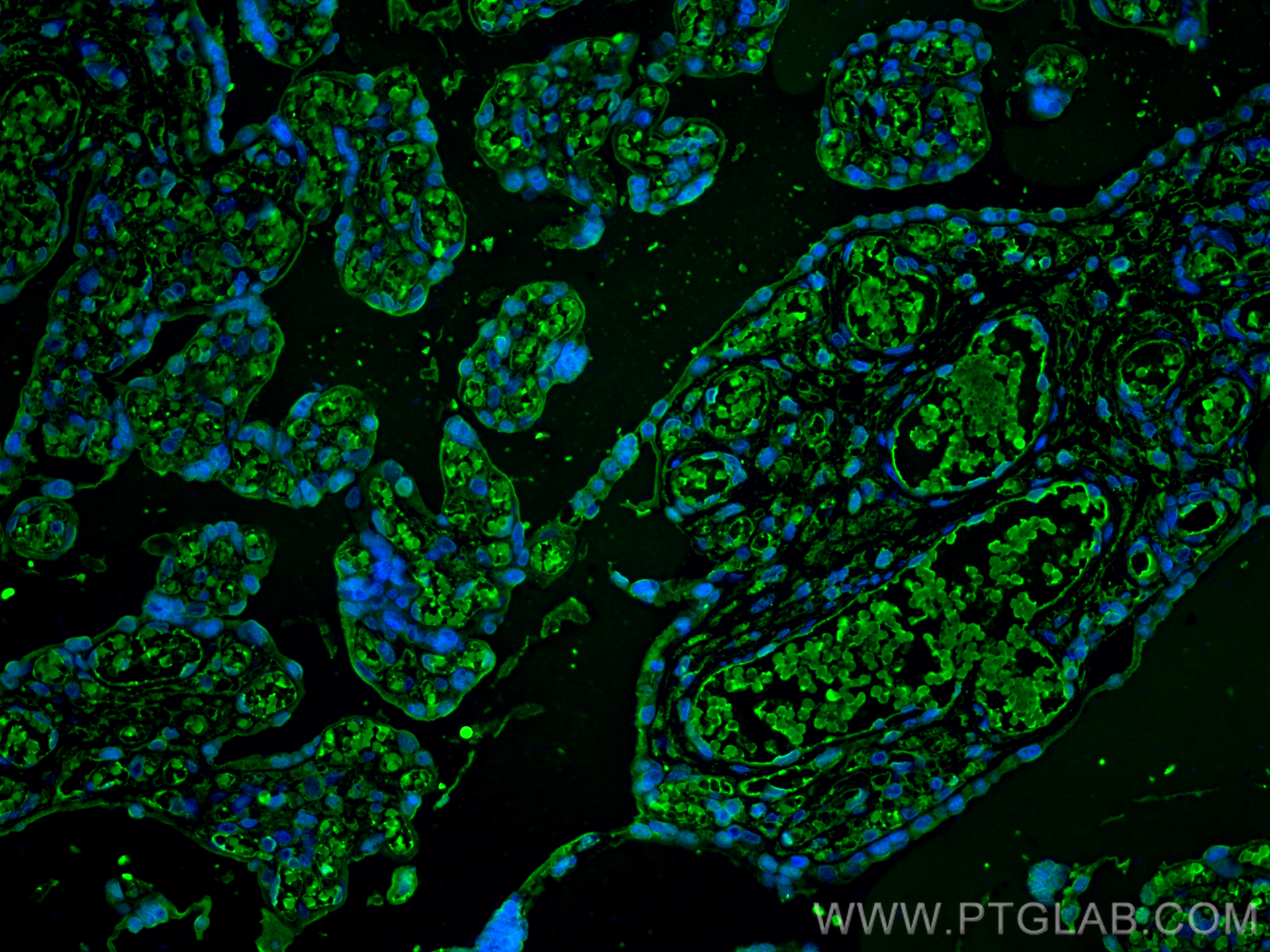 IF Staining of human placenta using 14537-1-AP