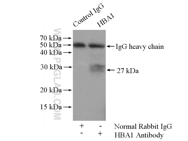 IP experiment of mouse liver using 14537-1-AP