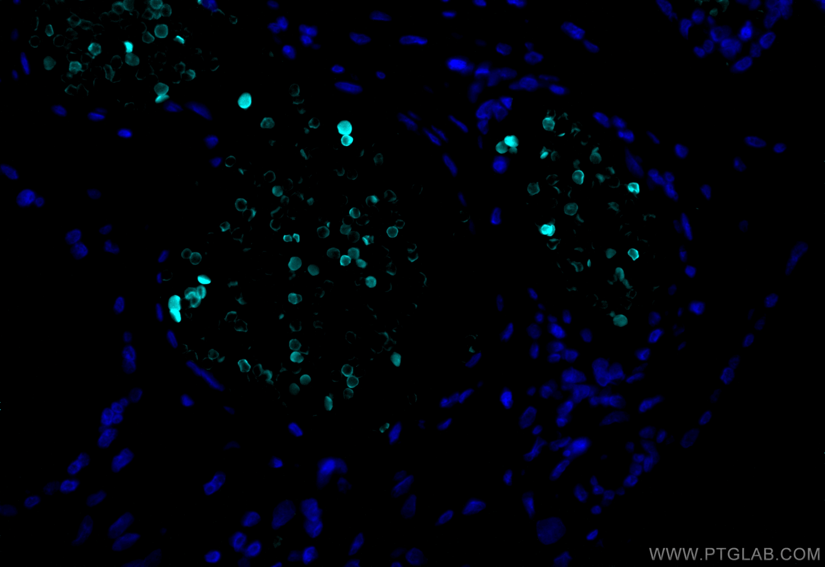 IF Staining of human placenta using CL750-16216