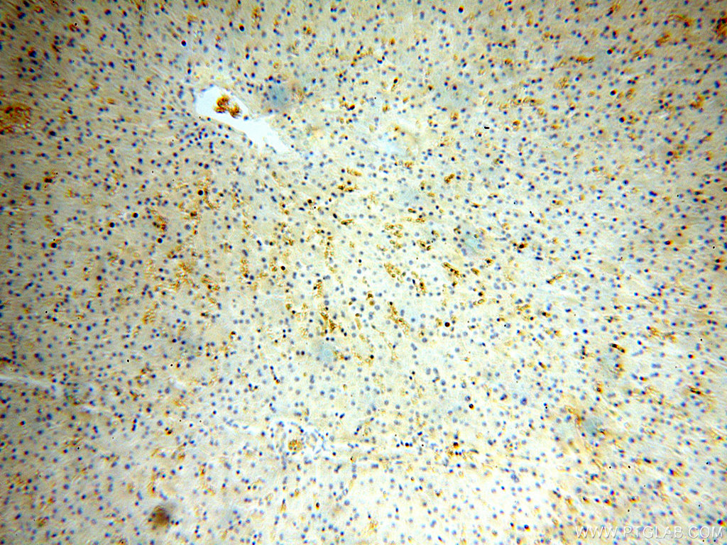 IHC staining of human liver using 16824-1-AP