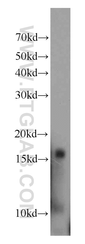 WB analysis of human plasma using 16824-1-AP