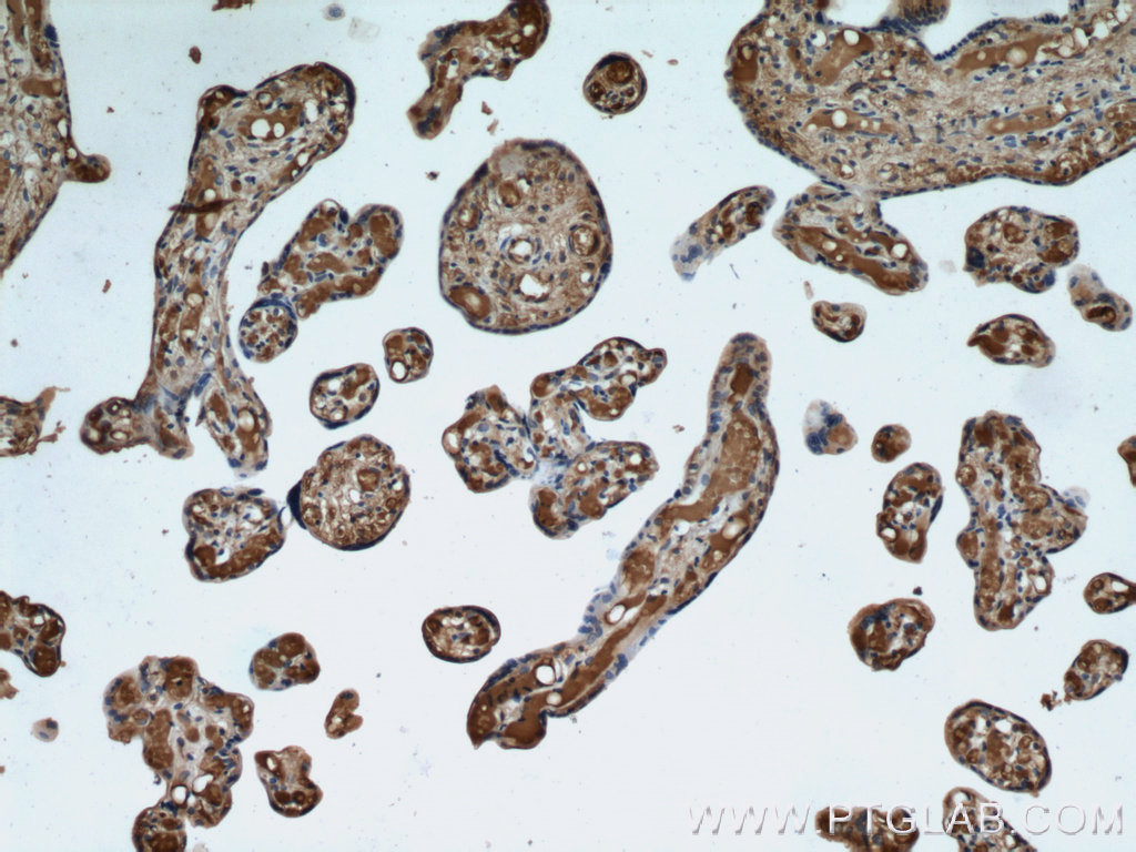IHC staining of human placenta using 12361-1-AP