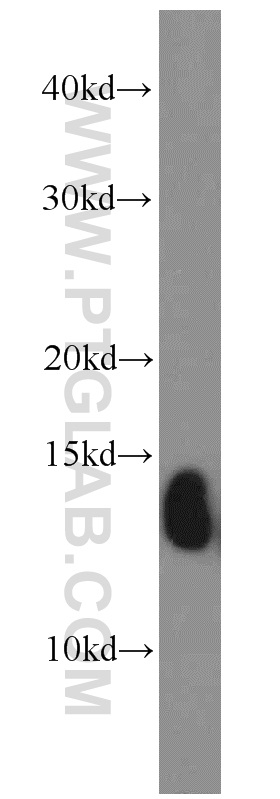 Hemoglobin Epsilon Polyclonal antibody