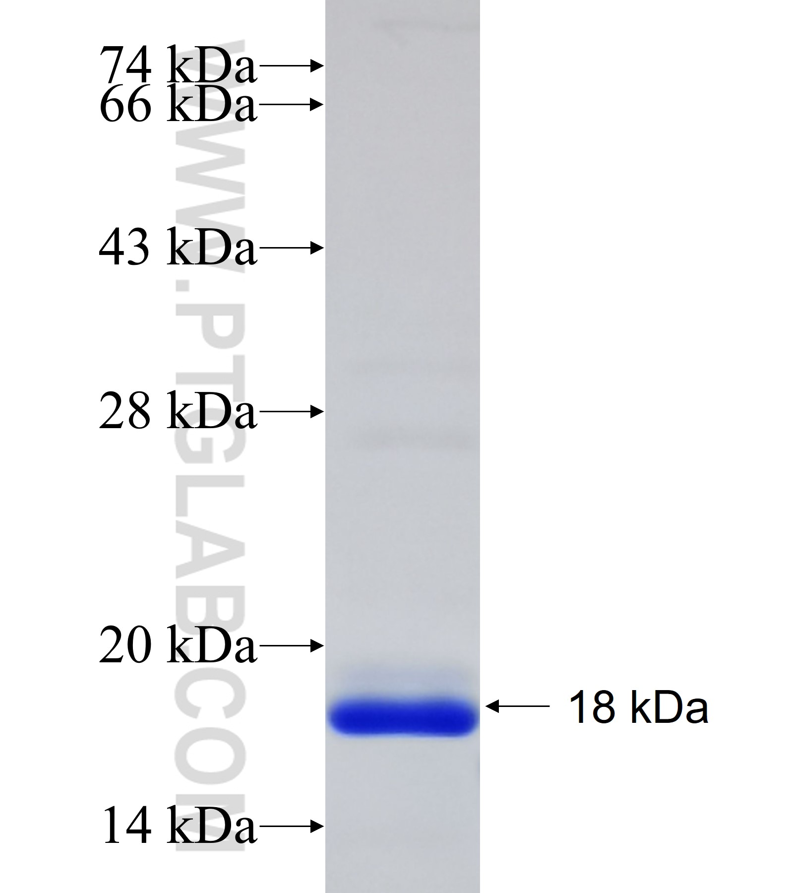 HBE1 fusion protein Ag19300 SDS-PAGE HBE1 fusion protein Ag19300 SDS-PAGE