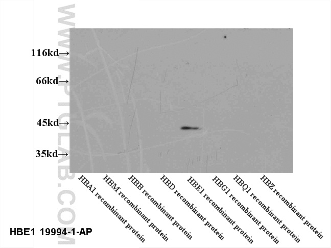 WB analysis of recombinant protein using 19994-1-AP