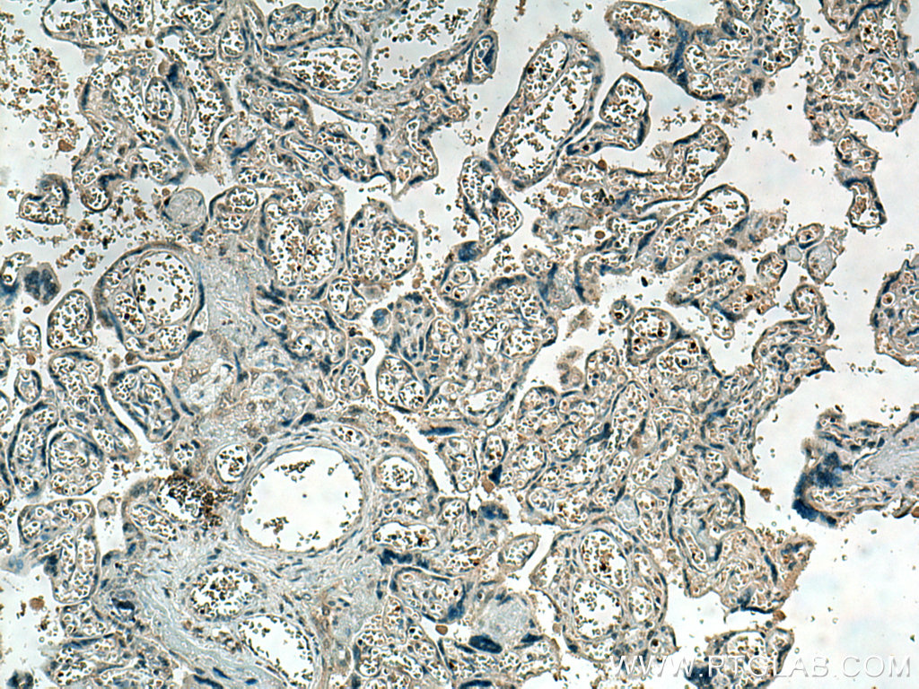 IHC staining of human placenta using 66151-1-Ig