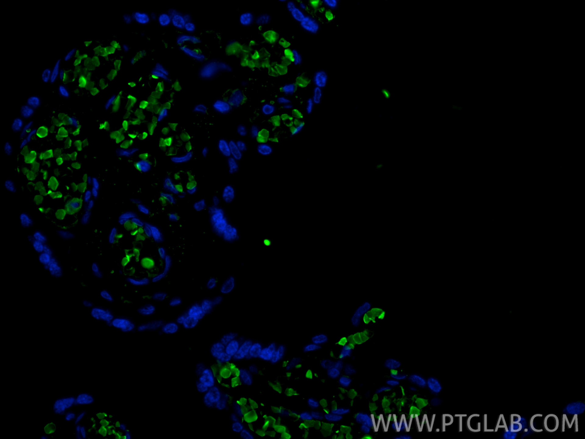 IF Staining of human placenta using 25728-1-AP IF Staining of human placenta using 25728-1-AP