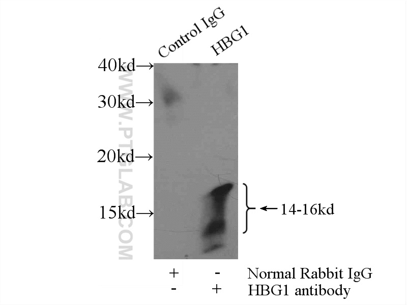 IP experiment of K-562 using 25728-1-AP