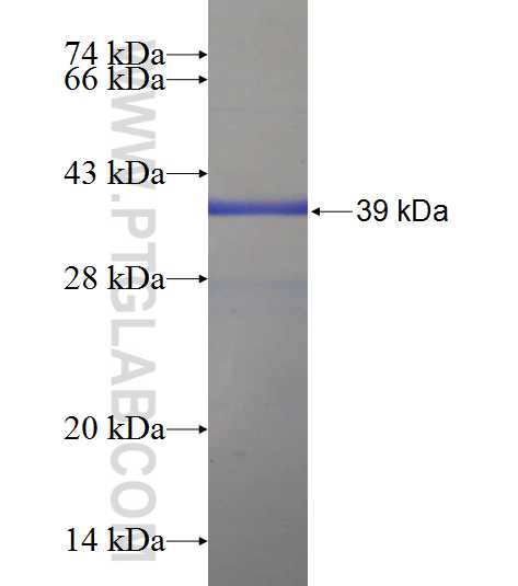 HBG1 fusion protein Ag22776 SDS-PAGE
