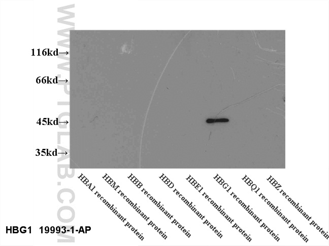 WB analysis of recombinant proein using 19993-1-AP
