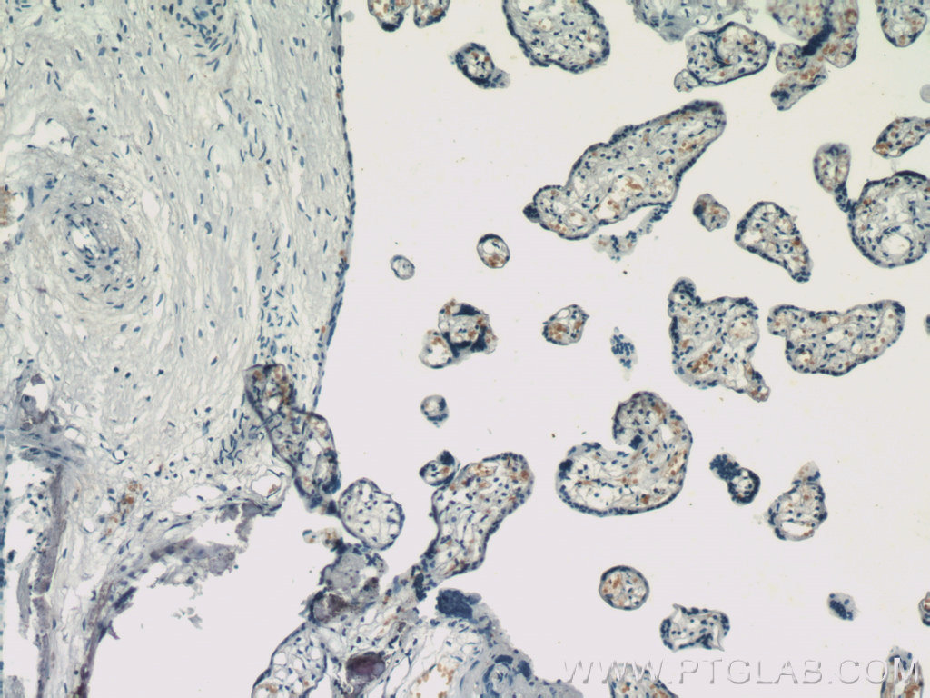 HBG1/2-Specific Monoclonal antibody