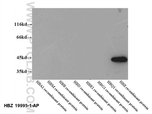 WB analysis of recombinant protein using 19995-1-AP