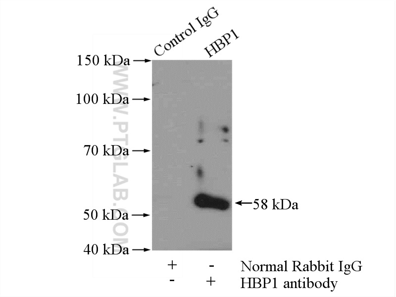 IP experiment of mouse brain using 11746-1-AP (same clone as 11746-1-PBS)