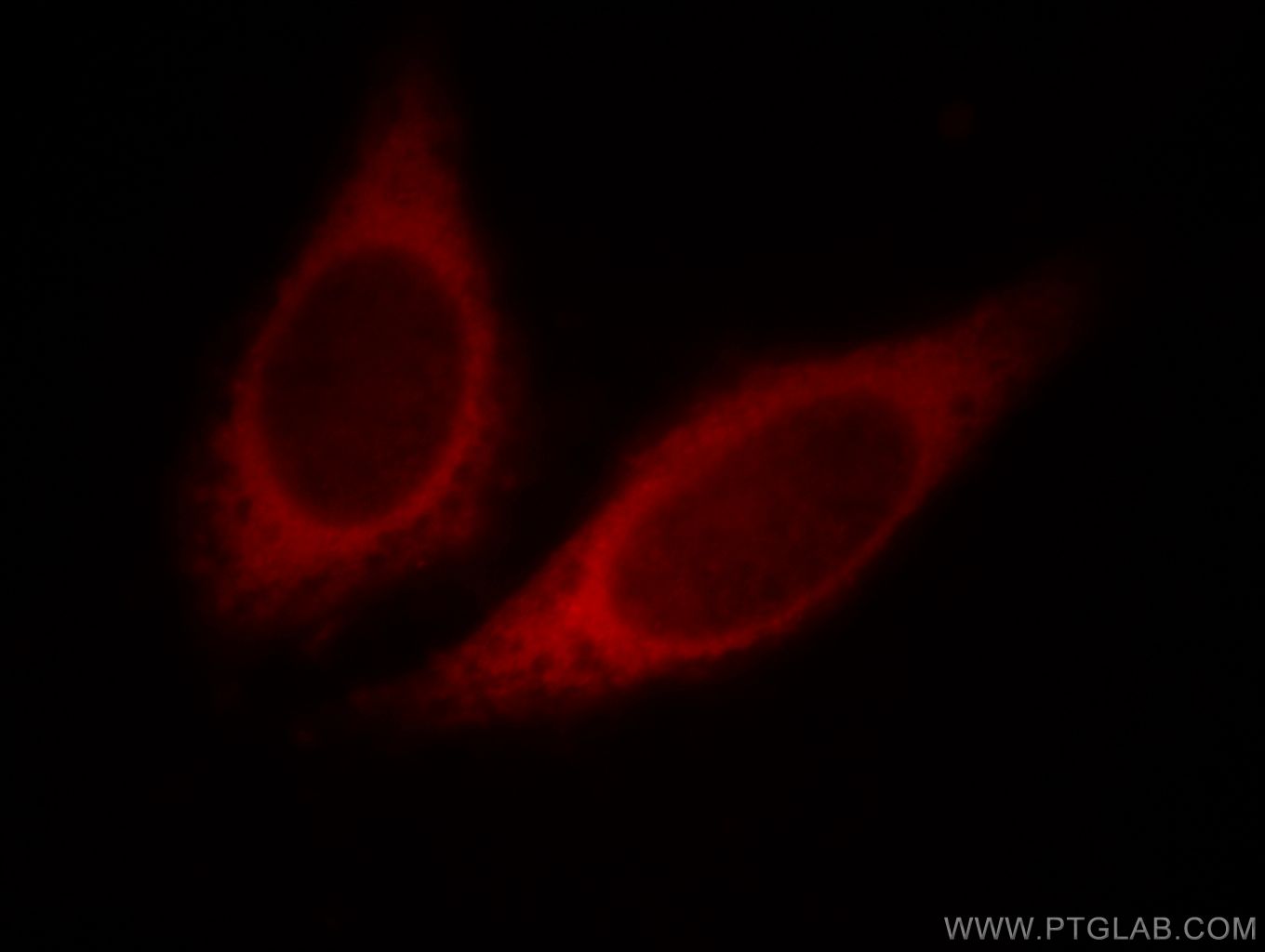 IF Staining of HepG2 using 10359-1-AP