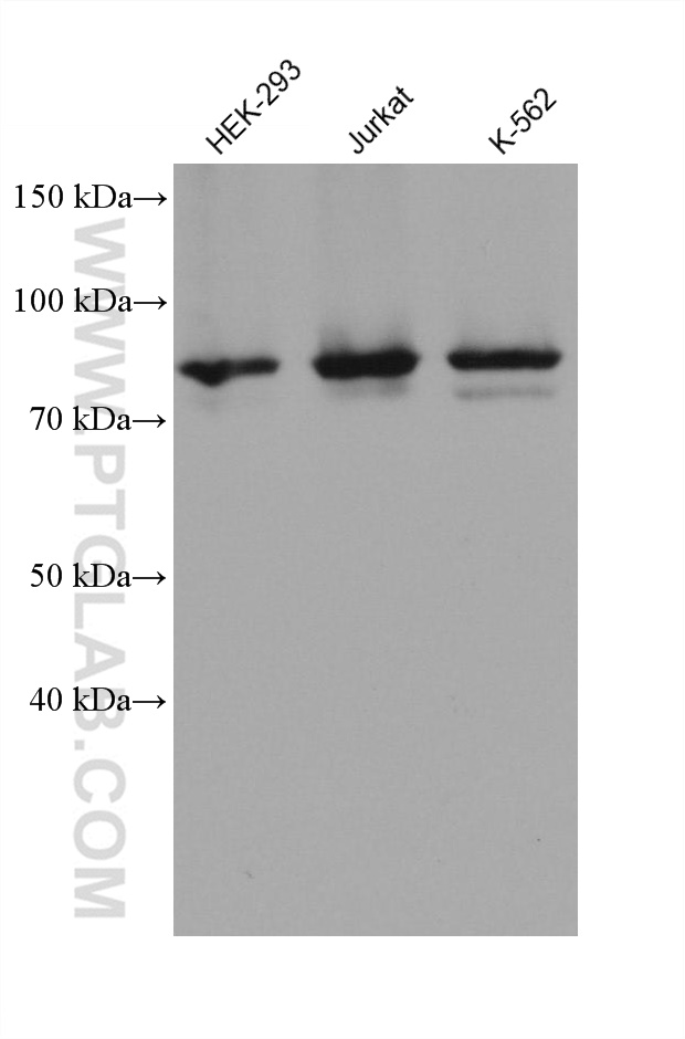 WB analysis using 68146-1-Ig