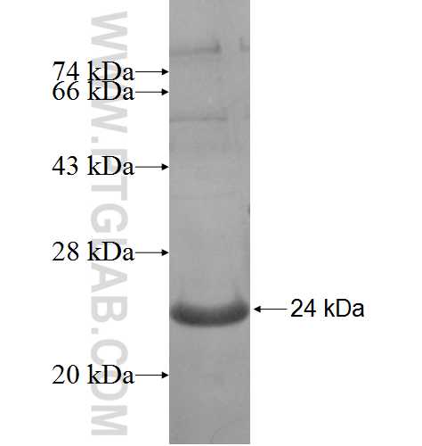 HBXIP fusion protein Ag6000 SDS-PAGE HBXIP fusion protein Ag6000 SDS-PAGE