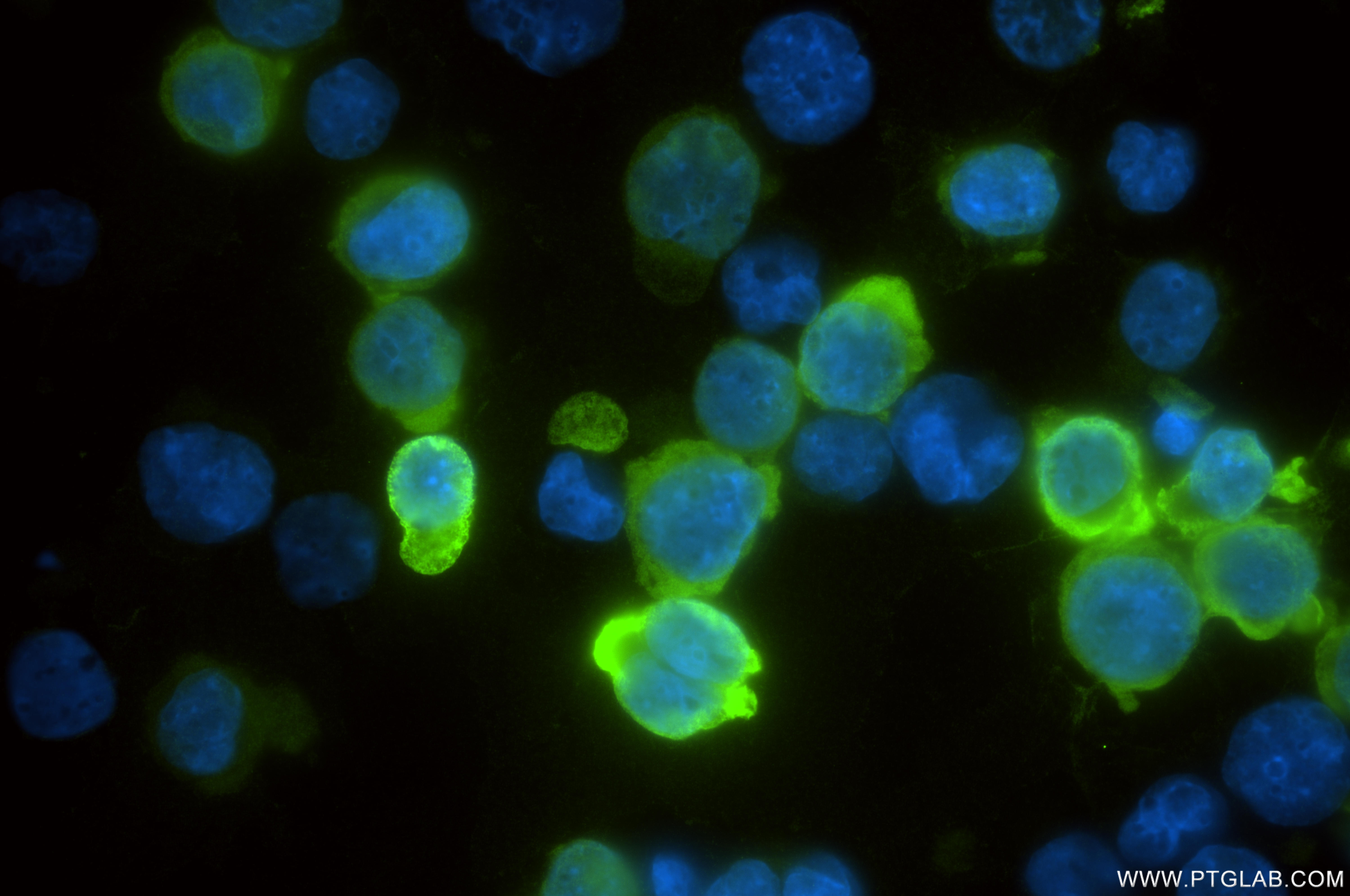 IF Staining of K-562 using 86879-3-RR