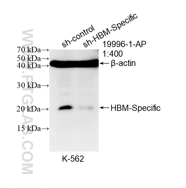 WB analysis of K-562 using 19996-1-AP WB analysis of K-562 using 19996-1-AP