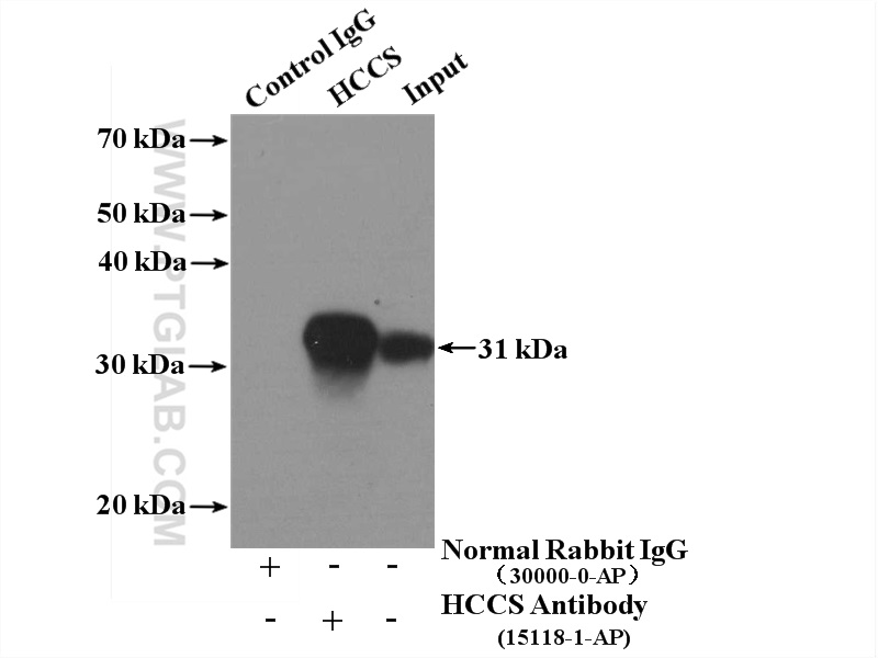 IP experiment of MCF-7 using 15118-1-AP