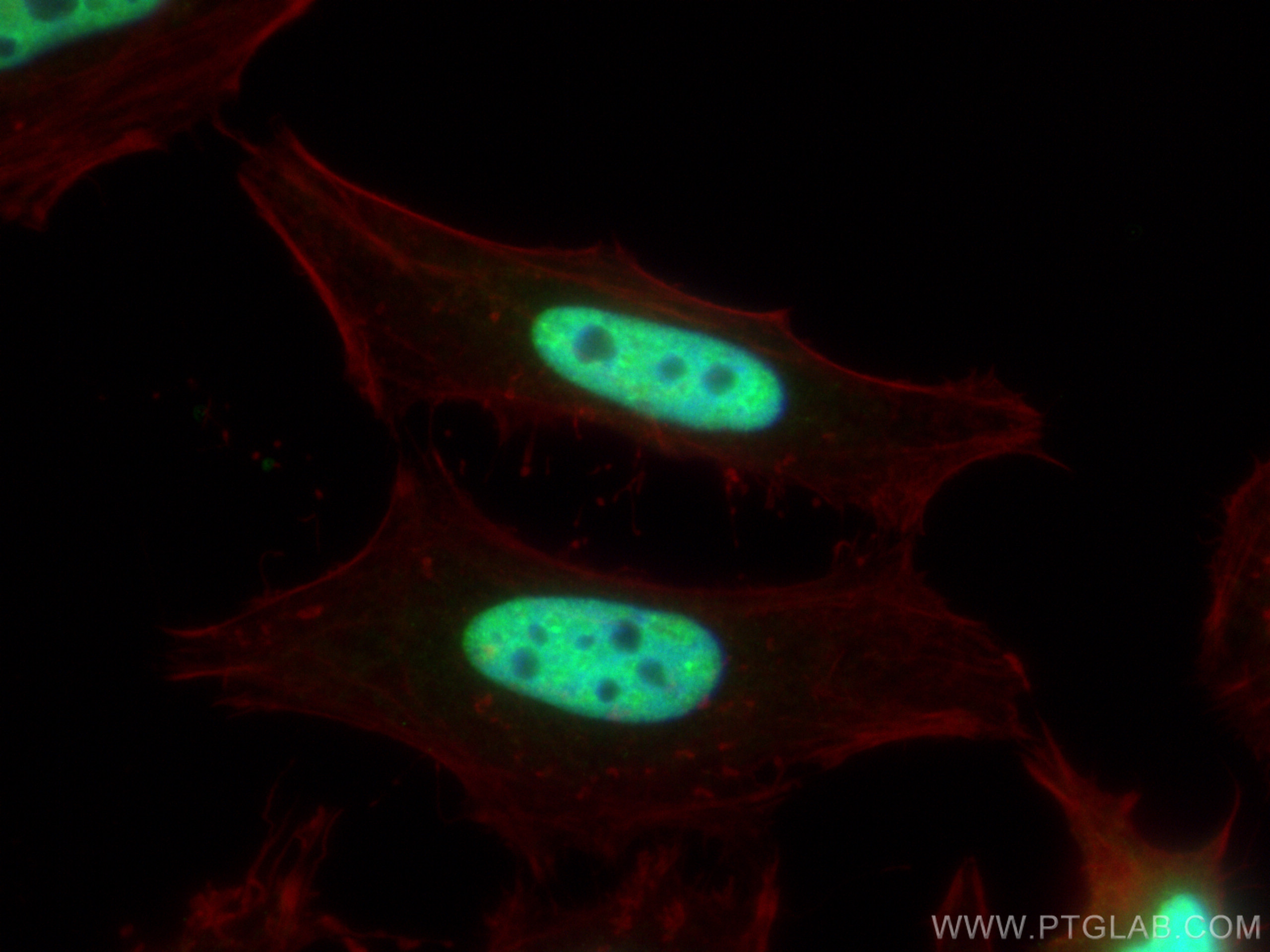 IF Staining of HeLa using 28569-1-AP (same clone as 28569-1-PBS)