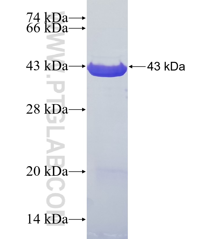 HCG22 fusion protein Ag35544 SDS-PAGE