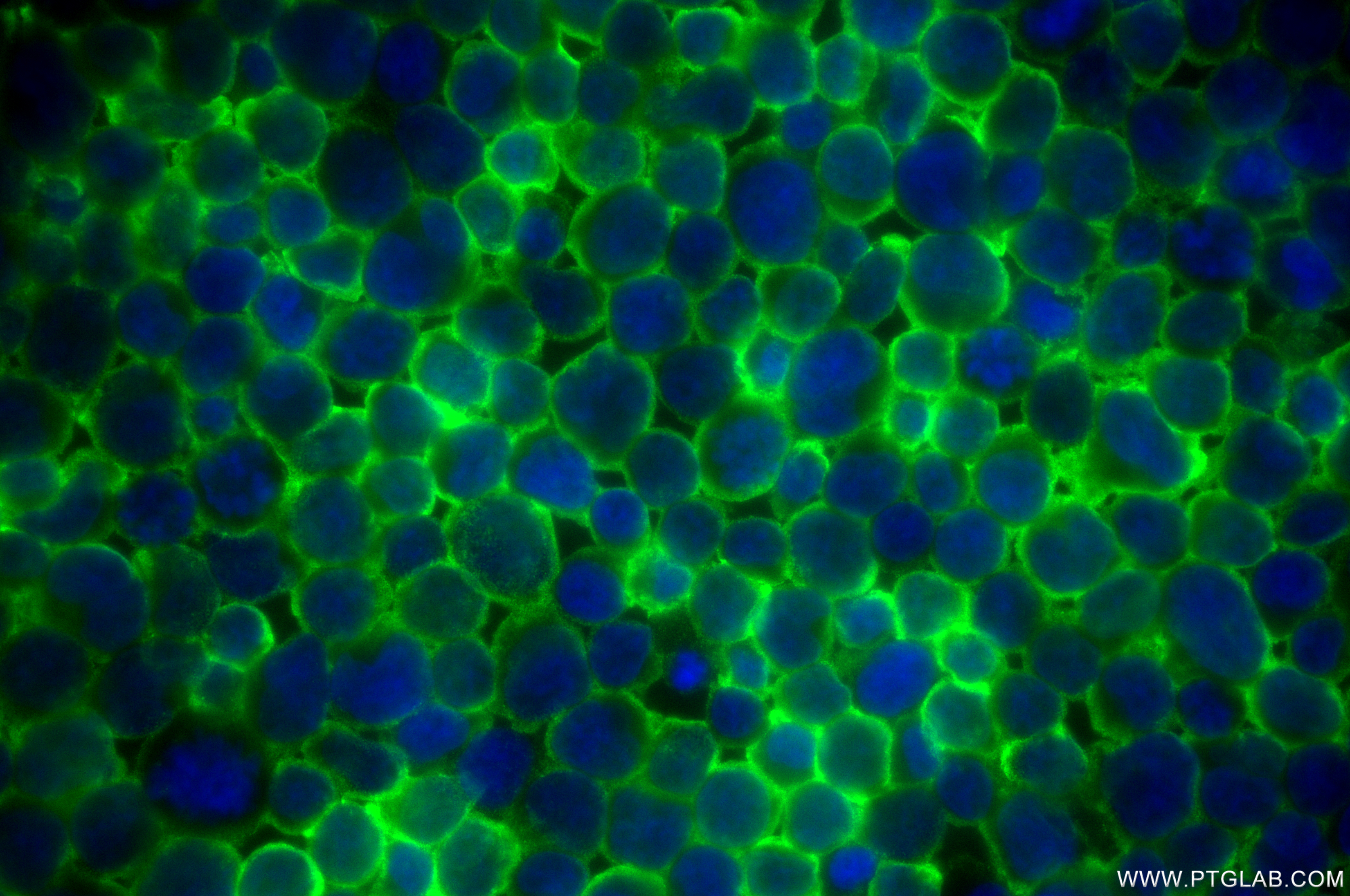 IF Staining of Jurkat using 85114-1-RR (same clone as 85114-1-PBS)