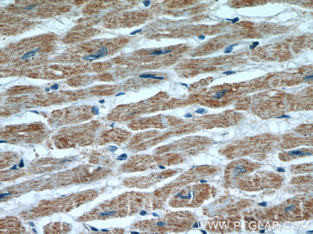 IHC staining of human heart using 55222-1-AP
