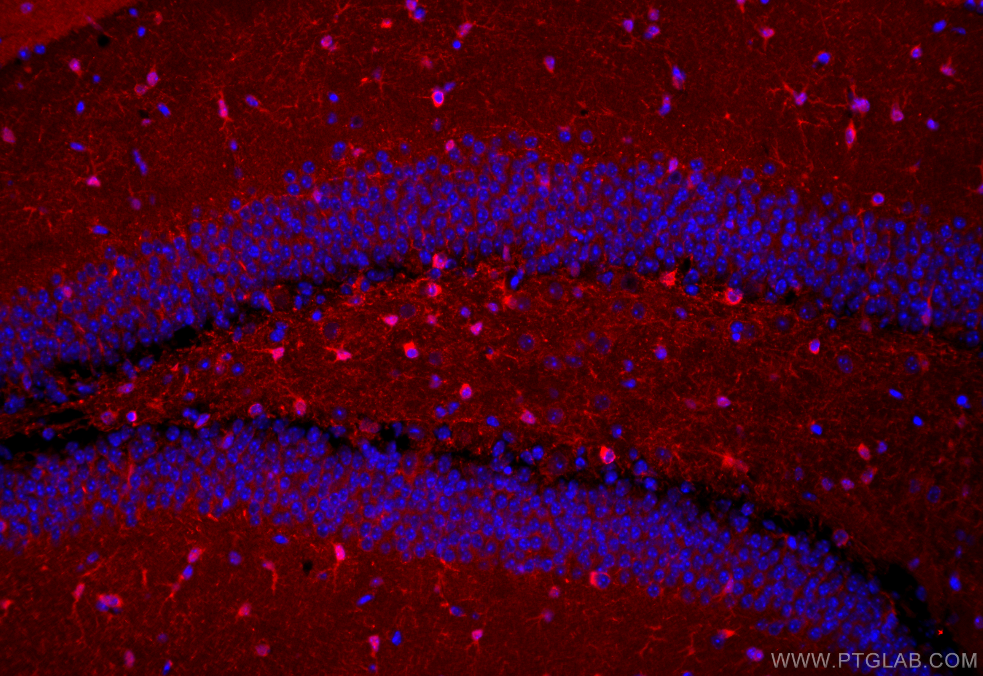 IF Staining of mouse brain using 30946-1-AP
