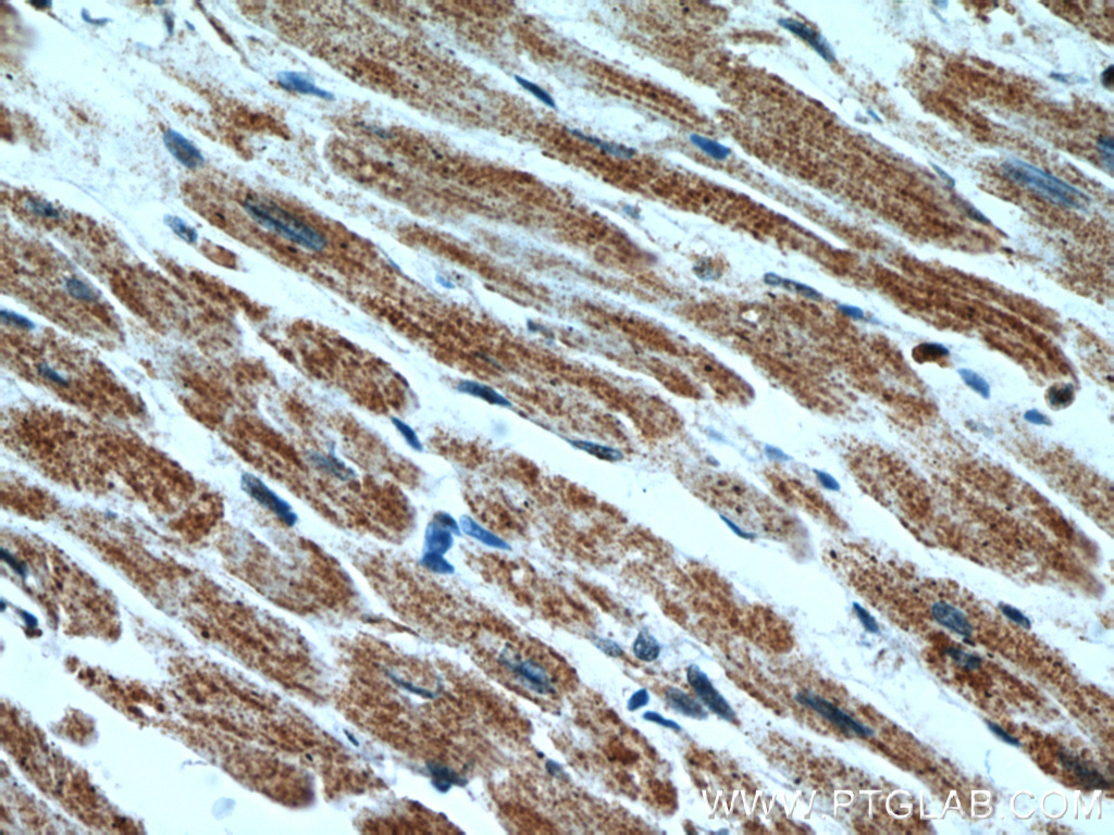 IHC staining of human heart using 55245-1-AP