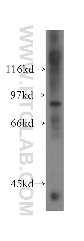 WB analysis of human kidney using 13745-1-AP